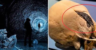 真有「穿越者」嗎？800年前秘魯人頭骨上，被植入奇怪的金屬物體
